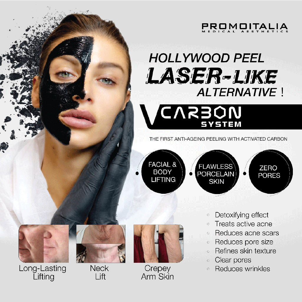 V CARBON SYSTEM 30 TRT