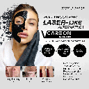 V CARBON SYSTEM 30 TRT